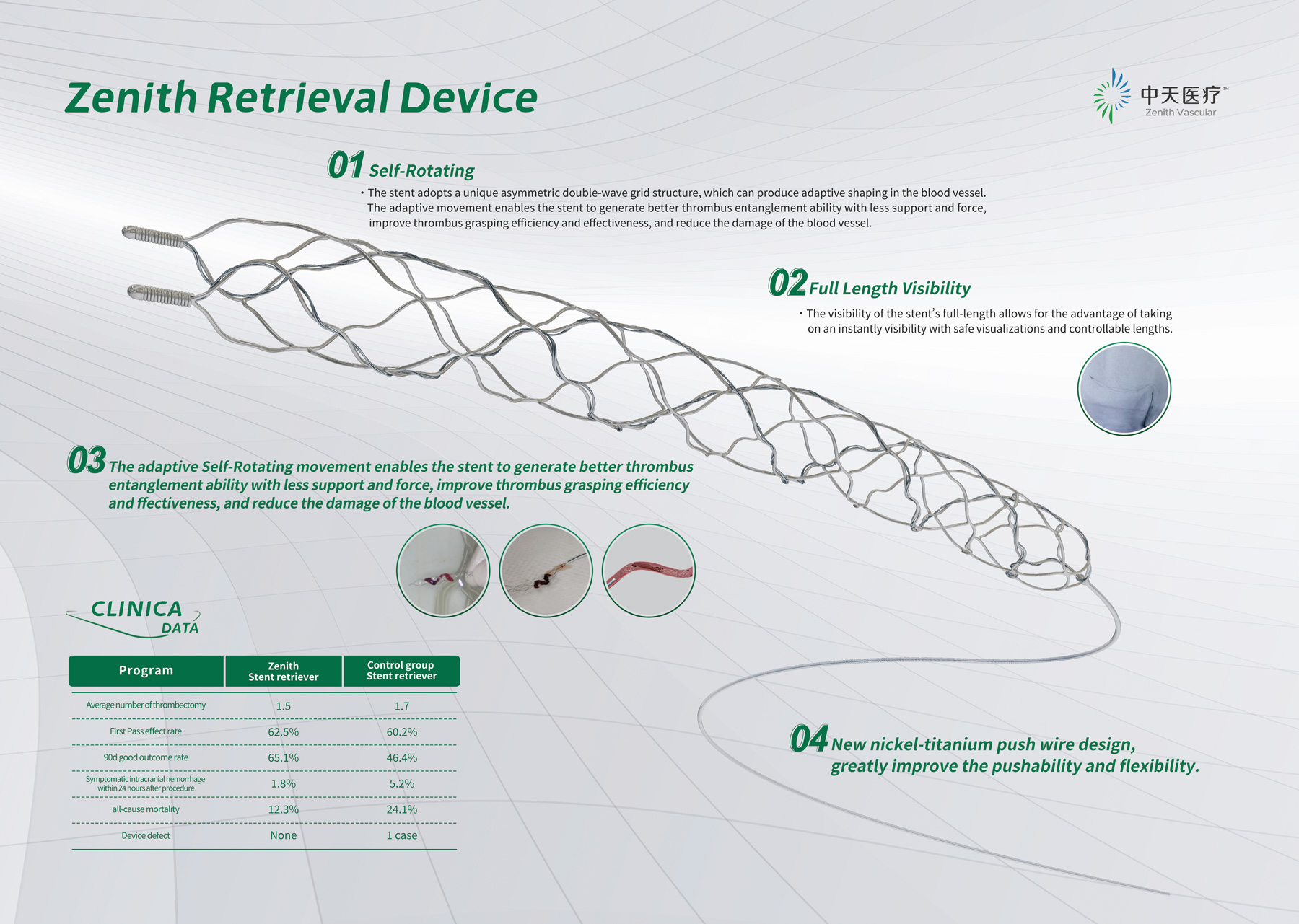 Retrieval Device