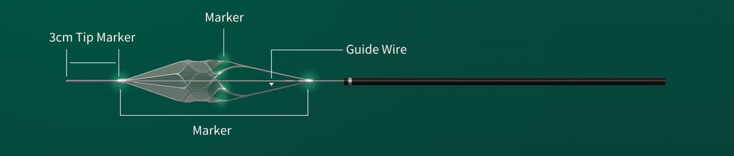 Embolic Protection System